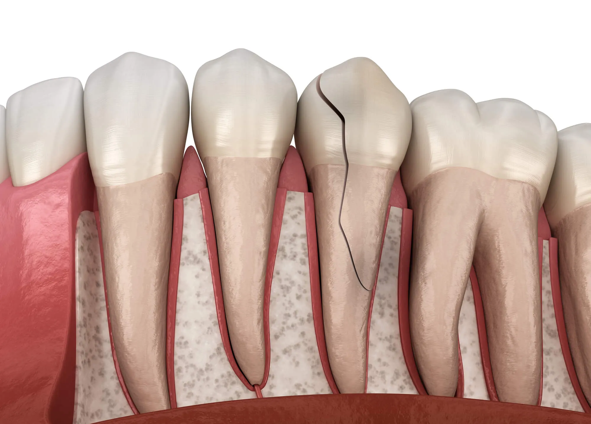a case for a new patient dental emergency leesburg va