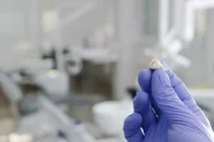 gloved hand holding a tooth after a tooth extraction in Leesburg, VA