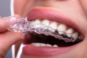 woman using orthodontics in Leesburg, VA
