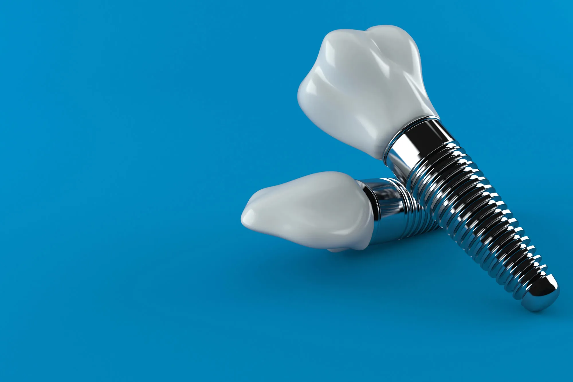 dental implants leesburg va